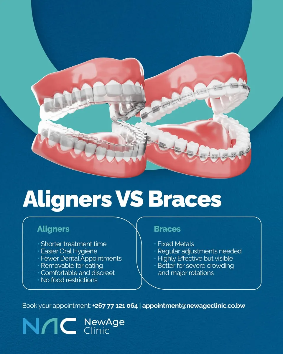 Model of teeth with clear aligners next to a model with metal braces